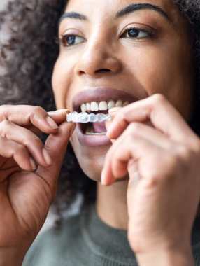 A woman putting in her Invisalign tray for teeth straightening